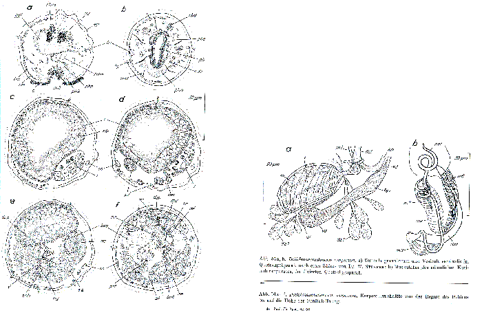 Dolichomacrostomum uniporum