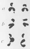Pseudostomum quadrioculatum