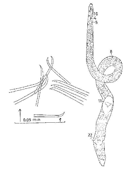 Coelogynopora tenuiformis