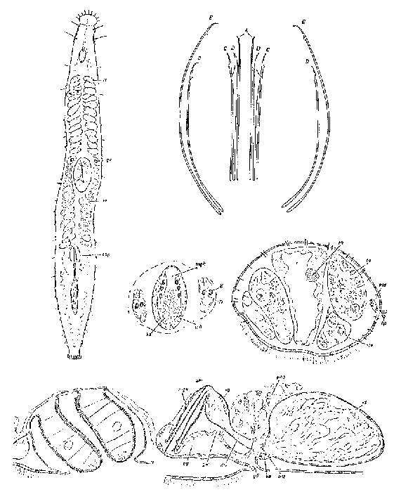 Postbursoplana fibulata