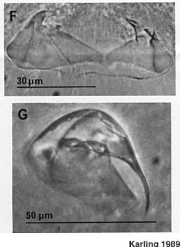 Uncinorhynchus flavidus