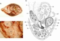 Platyhelminthes (flatworms)