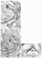 Platyhelminthes (flatworms)