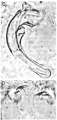 Platyhelminthes (flatworms)