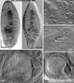 Acoelomorpha (acoelomorphs)