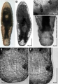 Acoelomorpha (acoelomorphs)