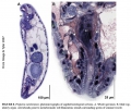 Acoelomorpha (acoelomorphs)