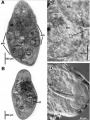 Acoelomorpha (acoelomorphs)