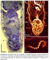 Acoelomorpha (acoelomorphs)