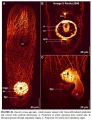 Acoelomorpha (acoelomorphs)