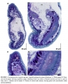 Acoelomorpha (acoelomorphs)