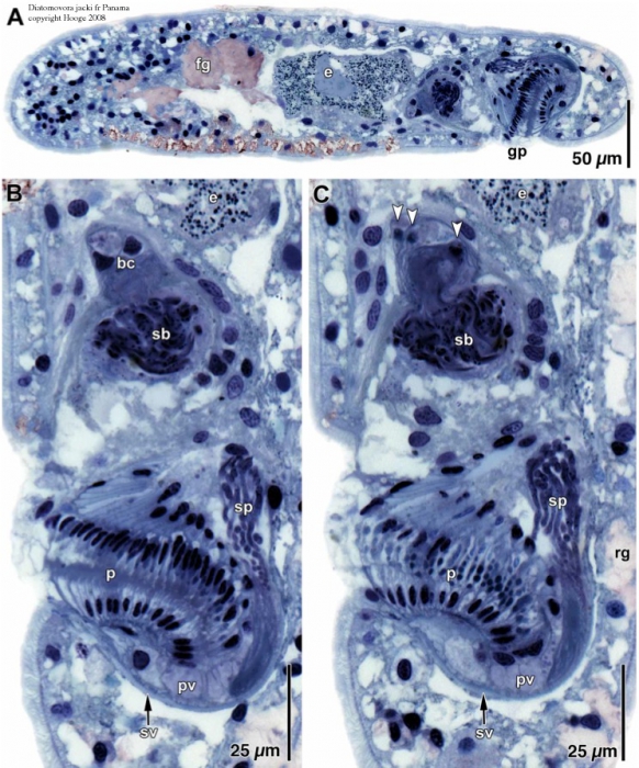 Diatomovora jacki