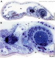 Acoelomorpha (acoelomorphs)