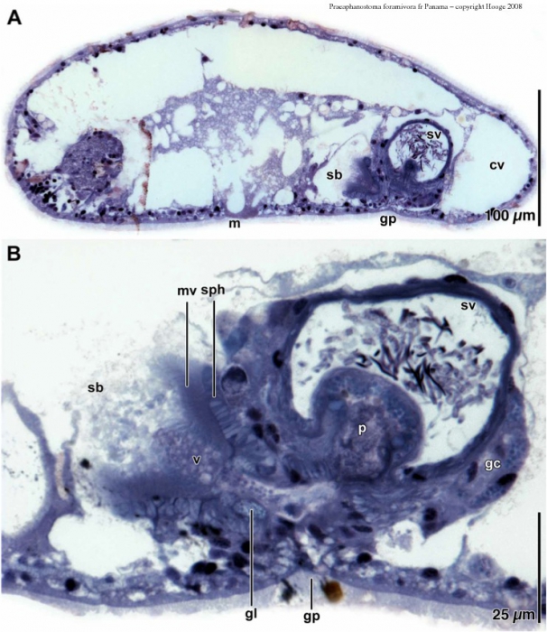 Praeaphanostoma foramivora