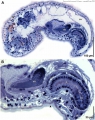 Acoelomorpha (acoelomorphs)