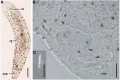 Acoelomorpha (acoelomorphs)