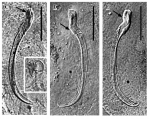 Limipolycystis falx