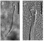 Limipolycystis wallbergi