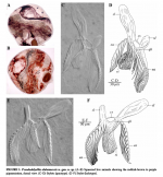 Pseudodalyellia alabamensis