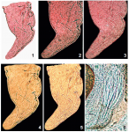 Morimiurella nakanoi