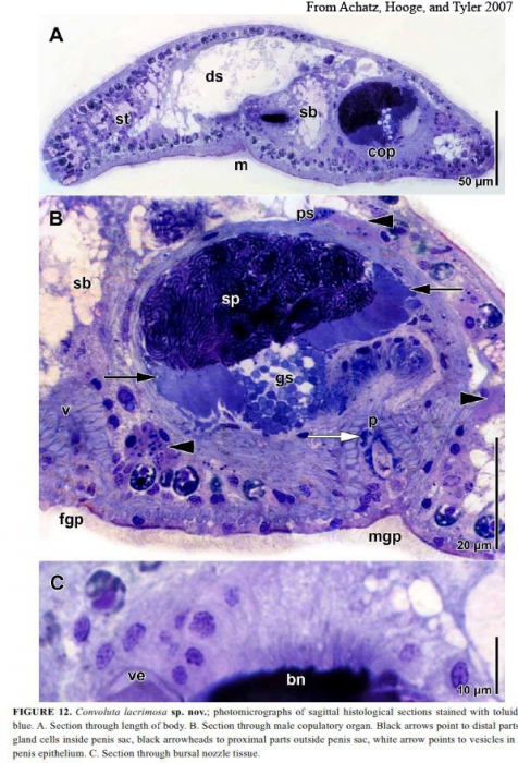 Convoluta lacrimosa