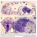 Acoelomorpha (acoelomorphs)