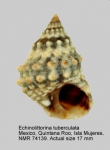 Echinolittorina tuberculata