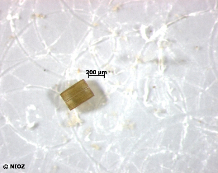 Coscinodiscus wailesii Gran & Angst, 1931 