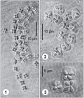 Myxospores of Kudoa inornata