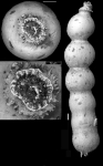 Chromista - Foraminifera (foraminifers)