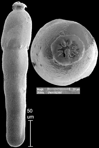 Strictocostella advena (Cushman & Laiming, 1931) Identified specimen