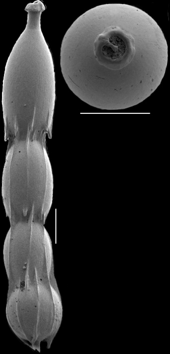 Unidens ishizakii Hayward & Kawagata, 2012. Holotype Unidens ishizakii Hayward & Kawagata, 2012. Holotype
