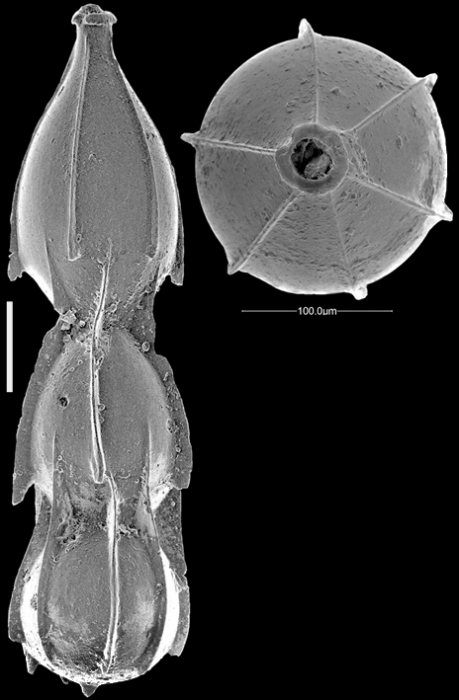 Unidens ishizakii Hayward & Kawagata, 2012, Paratype