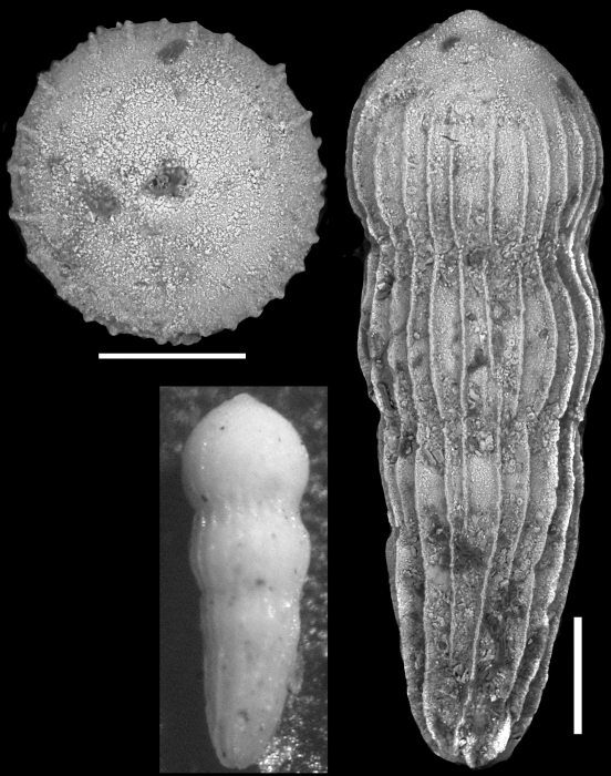 Nodosarella ignota Cushman & Siegfus, 1939. Holotype Nodosarella ignota Cushman & Siegfus, 1939. Holotype