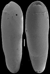 Ellipsoidella heronalleni (Storm, 1929) Identified specimen