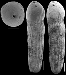 Ellipsoidella tappanae Hayward & Van Kerckhovem, 2012 Paratype