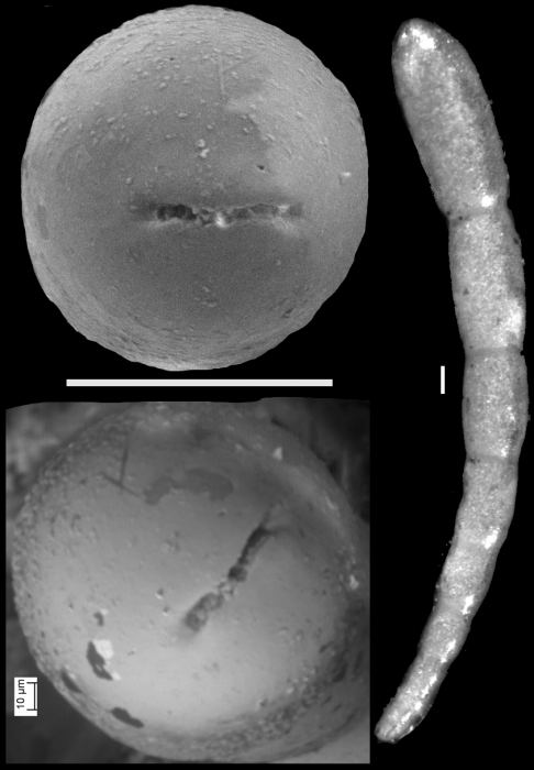 Drepaniota pachutaense Loeblich & Tappan, 1986 Holotype Drepaniota pachutaense Loeblich & Tappan, 1986 Holotype