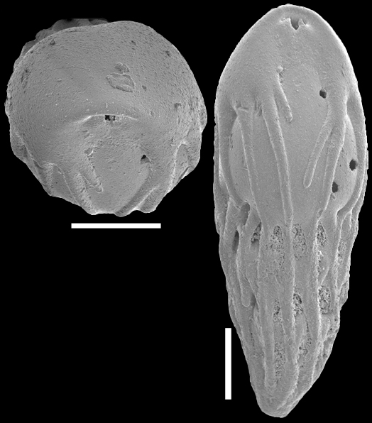 Neopleurostomella pendula (Boltovskoy & Watanabe, 1985). Identified specimen.