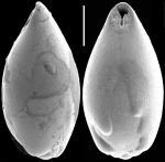 Chromista - Foraminifera (foraminifers)