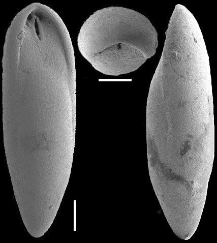 Obesopleurostomella boltovskoyi Hayward, 2012. Holotype