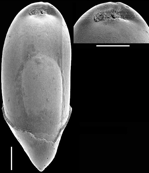 Obesopleurostomella boltovskoyi Hayward 2012. Paratype