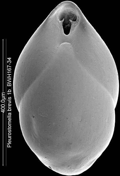 Obesopleurostomella brevis (Schwager, 1866). Identified specimen Obesopleurostomella brevis (Schwager, 1866). Identified specimen