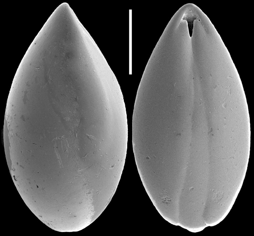 Obesopleurostomella pleurostomella (Silvestri, 1904) Identified specimen Obesopleurostomella pleurostomella (Silvestri, 1904) Identified specimen
