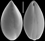 Obesopleurostomella pleurostomella (Silvestri, 1904) Identified specimen