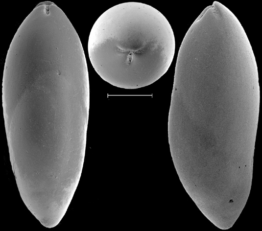 Ossaggittia thomasae Hayward & Kawagata, 2012 Holotype