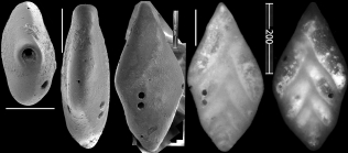 Pleurostomella frons Todd, 1957. Identified specimen.