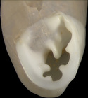 holotype; aperture