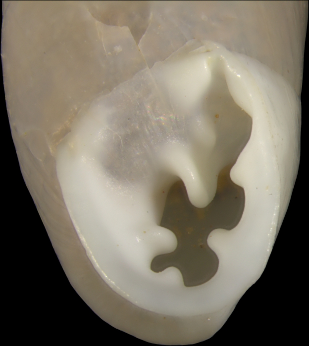 holotype; aperture holotype; aperture