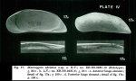 Macrocypris adriatica Breman et al., 1975 from original description