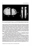 Actinocythereis brasiliensis Machado & Drozinski, 2002from original description 